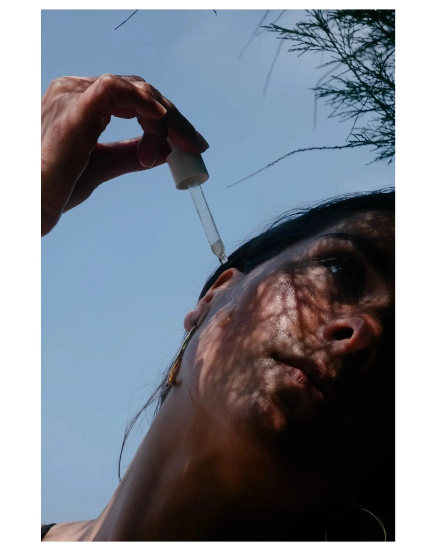 Anti-Blemish Solution - 30 ml