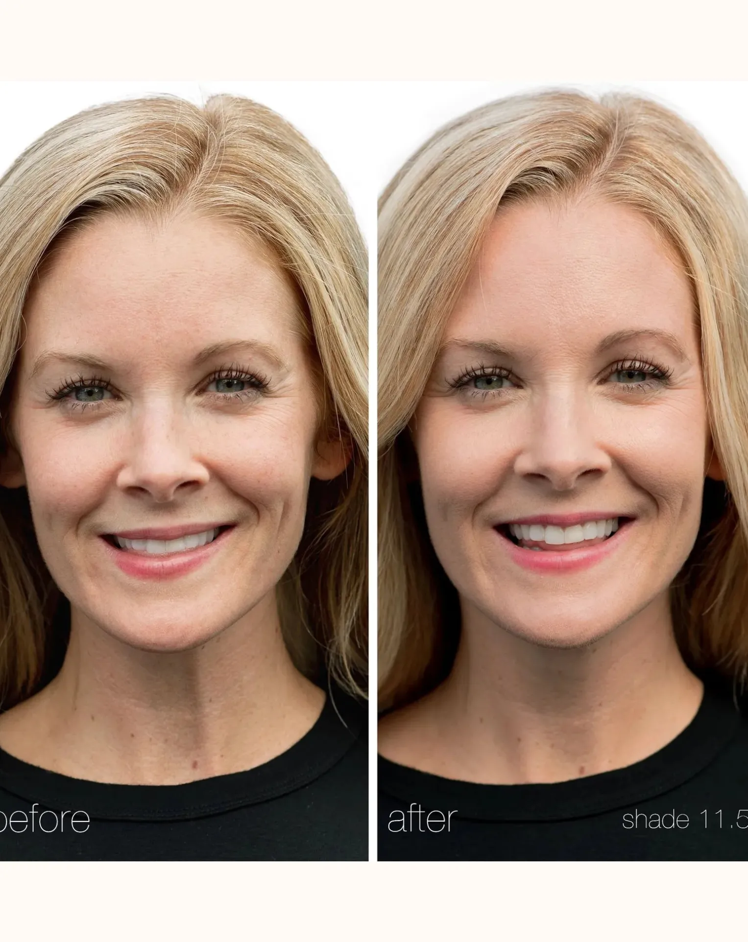 UnCoverup Concealer - 5.67g